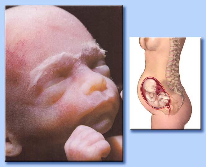 feto al sesto mese di gestazione