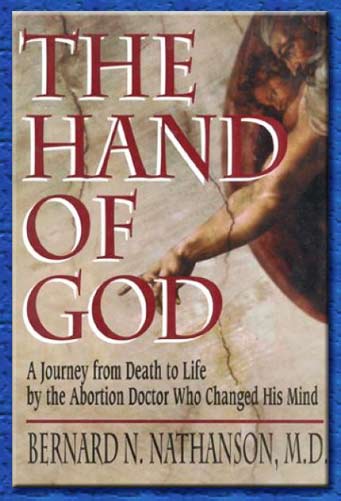 the hand of god - bernard nathanson