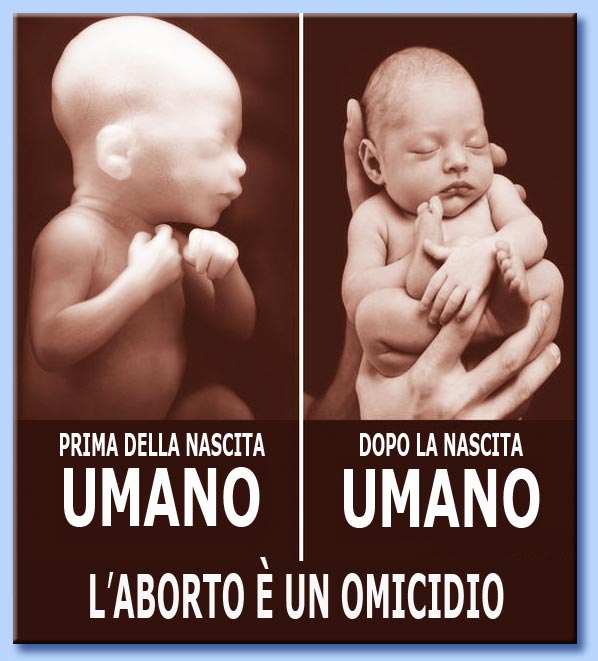 l'aborto  un omicidio