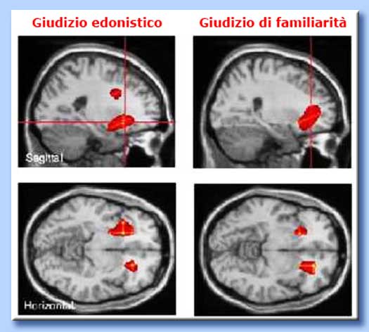 neuromarketing