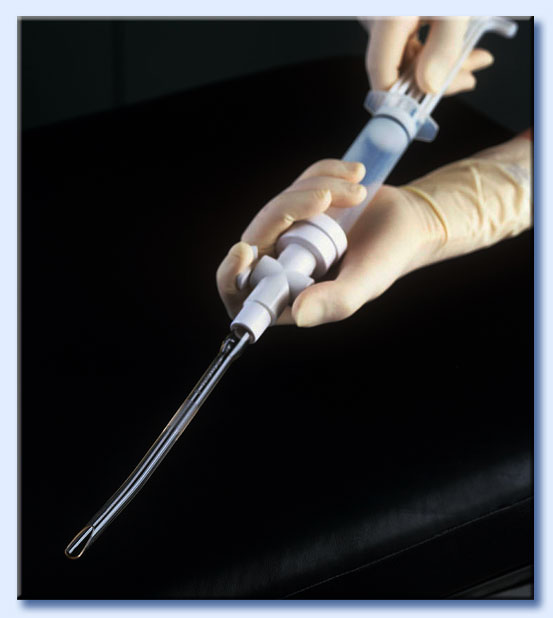 cannula aborto