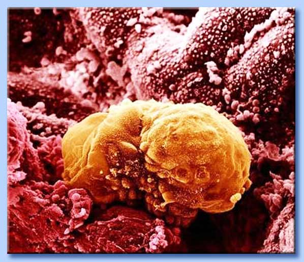 embrione umano nell'utero