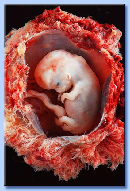 feto di dieci settimane