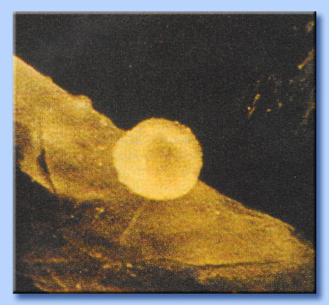 sindone - globulo rosso