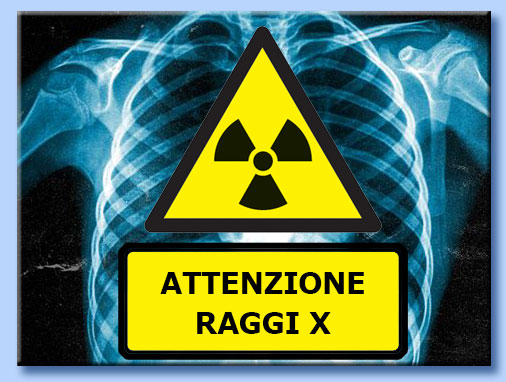 raggi x